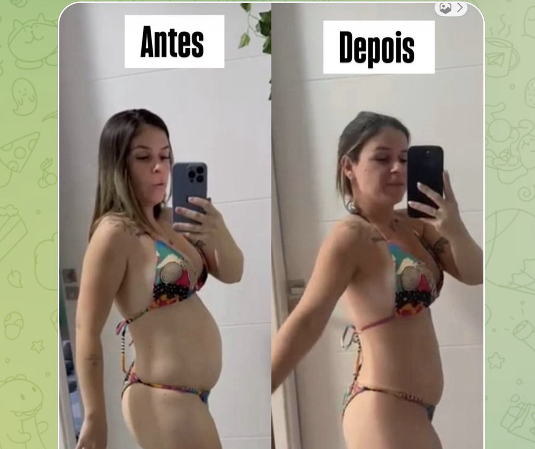Antes e depois de uma Musa após o combo Velmo Black